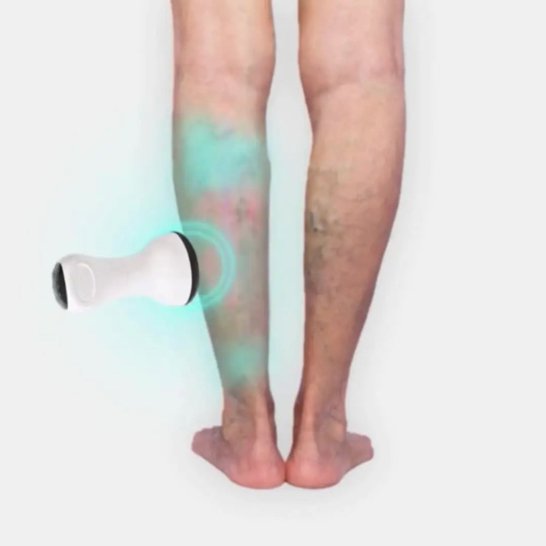 Wellnex LymphoPro® Therapy Device