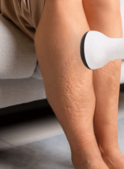 Wellnex LymphoPro® Therapy Device